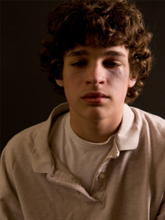 Boy with facial injuries